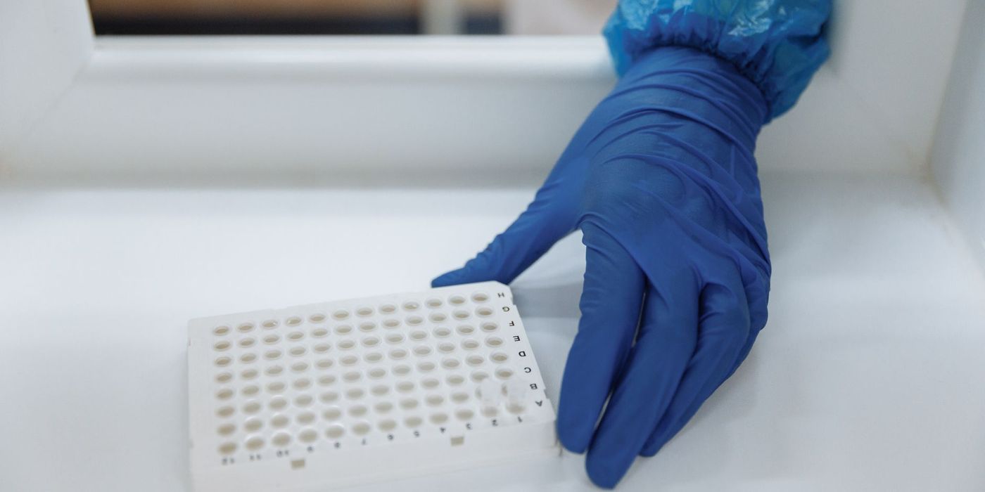 Laboratory testing of a food sample on a microplate